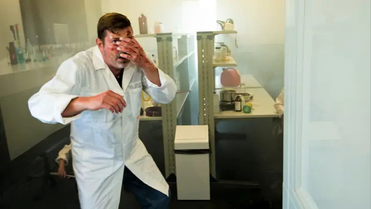 Persoon met brandwonden in gezicht en handen in een Laboratorium.