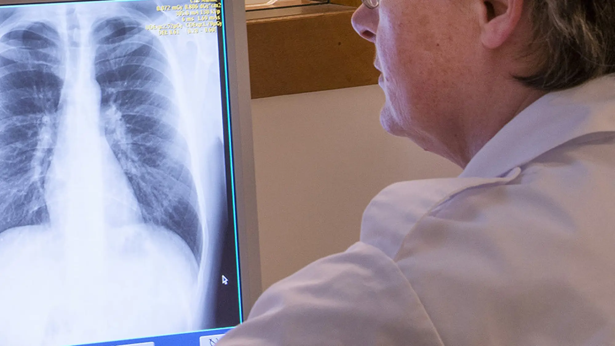 Een medisch persoon bekijkt een rontgenfoto van longen.